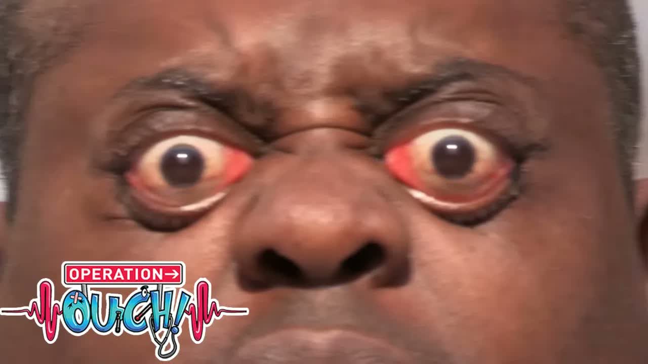 Don't Try This at Home! 👀 | Full Episode | Hospital Takeover | S1 E2 |  @OperationOuch