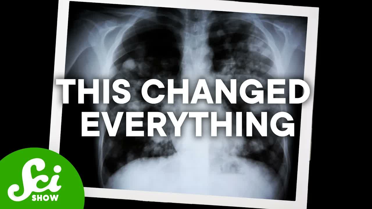 The Tragedy of the Cystic Fibrosis Cure