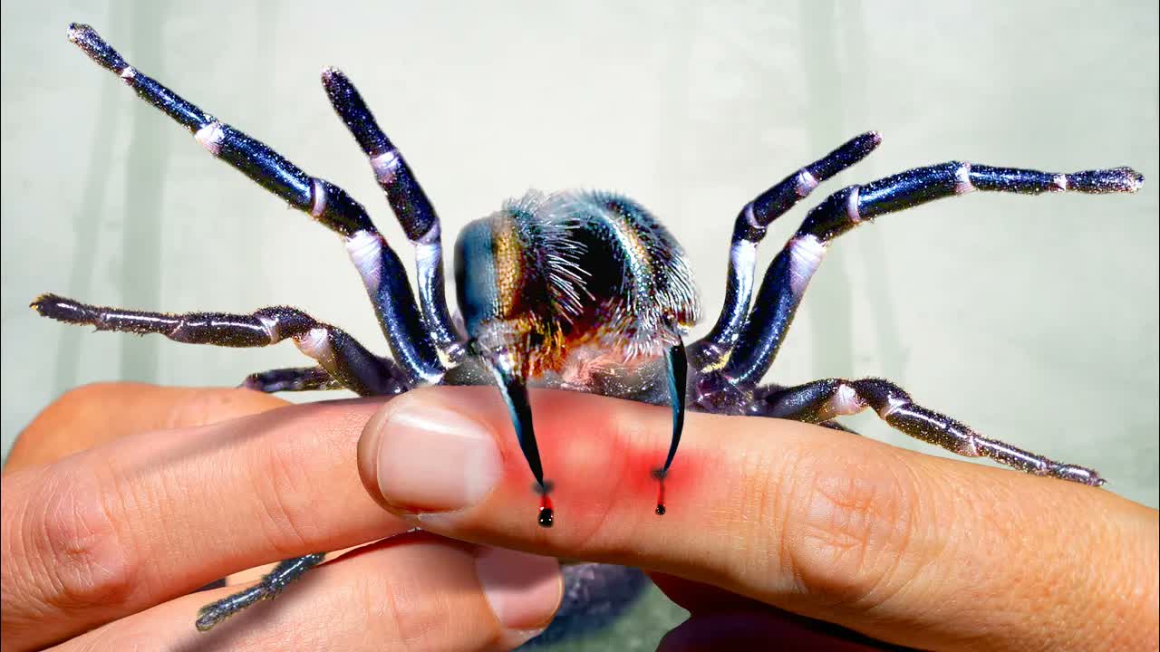 Bite from the Deadliest Spider! Needs Treatment