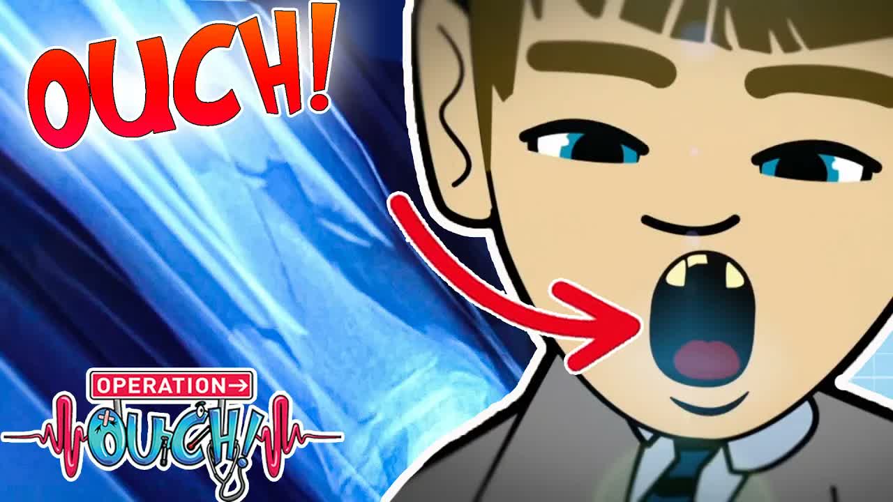 @OperationOuch - Broken Bones and Busted Teeth! | Science for Kids